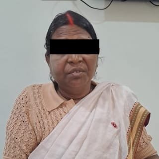 Facial Cellulitis After Treatment Result